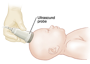 Gloved hand holding ultrasound probe to baby's head.