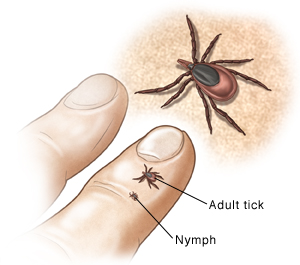 Nypmh and adult ticks shown on finger next to enlargement of tick image..