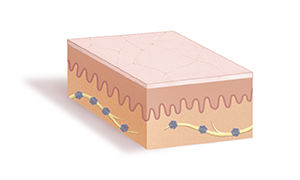 Section of skin showing herpes viruses inside nerves in dermis.