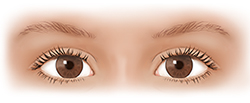 Front view of child’s eyes.