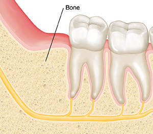 Closeup cross section of jawbone and molars showing bone where wisdom tooth was removed.