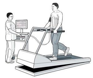 Healthcare provider monitoring man on treadmill doing exercise electrocardiagram.