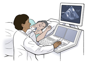 Woman lying on side on exam table with EKG leads on chest. Technician is holding ultrasound probe to woman's chest. 