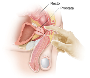 Vista lateral de los órganos pélvicos masculinos en la que se ve un tacto rectal.